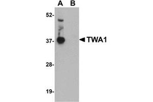 Western blot analysis of TWA1 in human brain tissue lysate with this product at 1 μg/ml in (A) the absence and (B) the presence of blocking peptide. (TTC5 Antikörper  (C-Term))