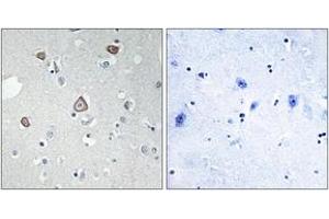 Immunohistochemistry analysis of paraffin-embedded human brain tissue, using GRM2 Antibody.