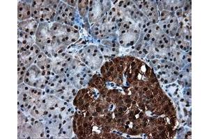 Immunohistochemical staining of paraffin-embedded colon tissue using anti-ACLY mouse monoclonal antibody. (ACLY Antikörper)