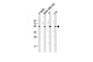 All lanes : Anti-WDR51B Antibody (C-term) at 1:2000 dilution Lane 1: human testis lysate Lane 2: MDA-MB-453 whole cell lysate Lane 3: TT whole cell lysate Lane 4: Y79 whole cell lysate Lysates/proteins at 20 μg per lane. (POC1B Antikörper  (C-Term))
