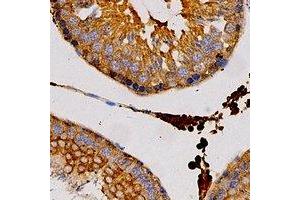 Immunohistochemistry (IHC) image for anti-Fatty Acid Binding Protein 3, Muscle and Heart (FABP3) antibody (ABIN7307772)