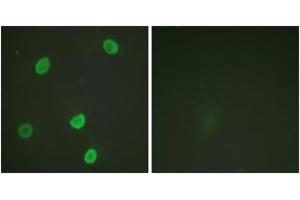 Immunofluorescence analysis of HeLa cells, using Histone H4 (Acetyl-Lys8) Antibody. (Histone H4 Antikörper  (acLys8))