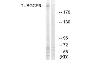 Western blot analysis of extracts from COLO cells, using TUBGCP6 antibody. (GCP6 Antikörper  (Internal Region))