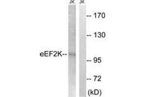 Western blot analysis of extracts from Jurkat cells, using eEF2K (Ab-359) Antibody.
