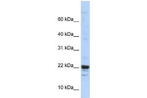 KIAA0040 antibody used at 5 ug/ml to detect target protein. (KIAA0040 Antikörper  (Middle Region))