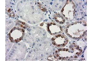 Immunohistochemical staining of paraffin-embedded Human Kidney tissue using anti-BECN1 mouse monoclonal antibody. (Beclin 1 Antikörper)