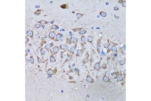 Immunohistochemistry (Paraffin-embedded Sections) (IHC (p)) image for anti-Interleukin-1 Receptor-Associated Kinase 4 (IRAK4) (AA 1-220) antibody (ABIN6142522)