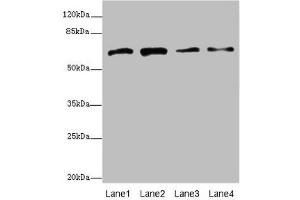 Western blot All lanes: GALNT2 antibody at 4.