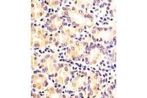(ABIN6242334 and ABIN6578174) staining FN3KRP in human Stomach sections by Immunohistochemistry (IHC-P - paraformaldehyde-fixed, paraffin-embedded sections).