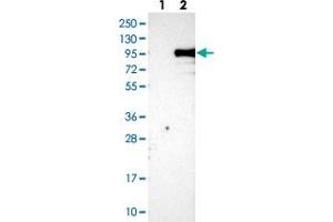 Western blot analysis of Lane 1: Negative control (vector only transfected HEK293T lysate), Lane 2: Over-expression Lysate (Co-expressed with a C-terminal myc-DDK tag (~3. (KIAA1586 Antikörper)