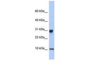 Image no. 1 for anti-Ribosomal Protein S21 (RPS21) (N-Term) antibody (ABIN6744006)