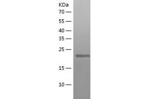 Western Blotting (WB) image for D-Tyrosyl-tRNA Deacylase 1 Homolog (S. Cerevisiae) (DTD1) (AA 1-209) protein (His tag) (ABIN7288036) (DTD1 Protein (AA 1-209) (His tag))
