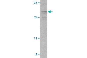 Western blot analysis of PIGY in A-20 cell lysate with PIGY polyclonal antibody  at 2 ug/mL . (PIGY Antikörper  (C-Term))