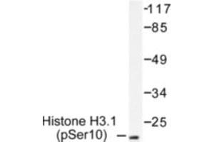 Image no. 1 for anti-Histone H3.1 (HIST1H3B) (pSer10) antibody (ABIN318041) (Histone H3.1 Antikörper  (pSer10))