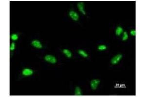 Immunostaining analysis in HeLa cells. (ZSCAN21 Antikörper)