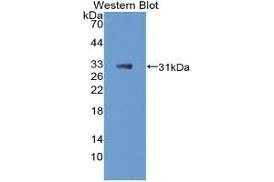 Detection of Recombinant TBX21, Mouse using Polyclonal Antibody to T-Box Protein 21 (TBX21) (T-Bet Antikörper  (AA 160-399))