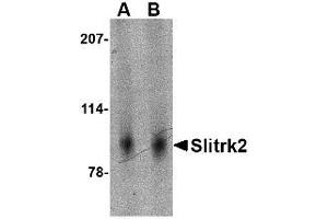 Image no. 1 for anti-SLIT and NTRK-Like Family, Member 2 (SLITRK2) (Internal Region) antibody (ABIN1493816) (SLITRK2 Antikörper  (Internal Region))
