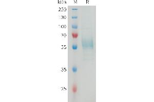 SDS-PAGE (SDS) image for Triggering Receptor Expressed On Myeloid Cells 2 (TREM2) (AA 19-171) protein (Fc Tag) (ABIN7538568)