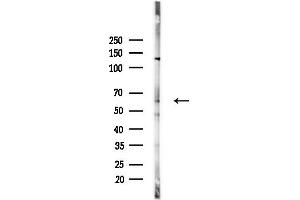 Western blot analysis of lysates from Mouse liver, using Cytochrome P450 4V2 Antibody at 1/1000 dilution.