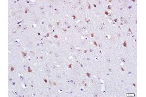 Paraformaldehyde-fixed, paraffin embedded mouse brain tissue, Antigen retrieval by boiling in sodium citrate buffer(pH6) for 15min, Block endogenous peroxidase by 3% hydrogen peroxide for 30 minutes, Blocking buffer (normal goat serum) at 37°C for 20min, Antibody incubation with Rabbit Anti-CNG Channel beta 1 Polyclonal Antibody, Unconjugated  at 1:400 overnight at 4°C, followed by a conjugated secondary and DAB staining (CNG Channel beta 1/truncated GARP (AA 851-950) Antikörper)
