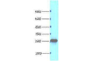 Western Blotting (WB) image for anti-B-Cell CLL/lymphoma 2 (BCL2) antibody (ABIN3181112)