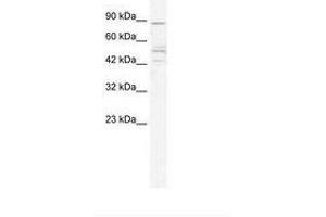 Image no. 1 for anti-Cholinergic Receptor, Nicotinic, beta 2 (Neuronal) (CHRNB2) (AA 156-205) antibody (ABIN202672) (CHRNB2 Antikörper  (AA 156-205))