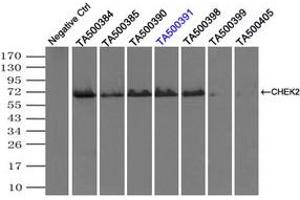 Image no. 1 for anti-Checkpoint Kinase 2 (CHEK2) antibody (ABIN1497499) (CHEK2 Antikörper)