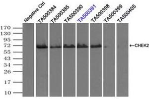 Image no. 1 for anti-Checkpoint Kinase 2 (CHEK2) antibody (ABIN1497499)