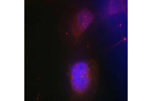 Immunofluorescence staining of methanol-fixed HeLa cells using BRCA1 (phospho-Ser988) antibody (E011237, Red) (BRCA1 Antikörper  (pSer988))