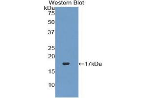 WB of Protein Standard: different control antibodies against Highly purified E. (TGFB3 CLIA Kit)