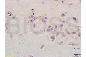 Formalin-fixed and paraffin embedded human placenta tissue labeled with Anti-CSIG Polyclonal Antibody, Unconjugated (ABIN728248) at 1:200 followed by conjugation to the secondary antibody and DAB staining (RSL1D1 Antikörper  (AA 151-250))