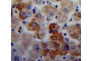 Used in DAB staining on fromalin fixed paraffin-embedded Liver tissue (IGLL1 Antikörper  (AA 112-206))