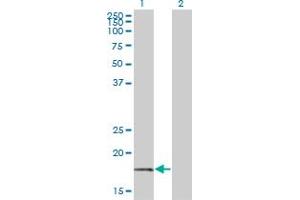 Western Blot analysis of BTF3 expression in transfected 293T cell line by BTF3 monoclonal antibody (M01), clone 3C4-2E11. (BTF3 Antikörper  (AA 1-162))