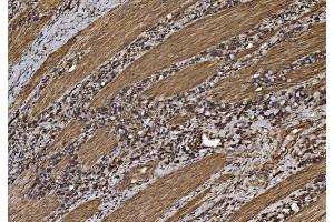 IHC analysis of EIF5 using anti-EIF5 antibody (ABIN7599722).