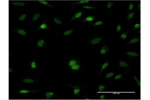 Immunofluorescence of monoclonal antibody to RFC5 on HeLa cell. (RFC5 Antikörper  (AA 1-340))