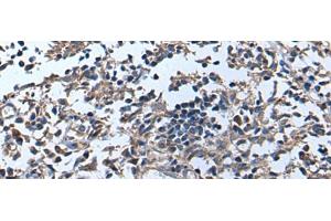Immunohistochemistry of paraffin-embedded Human tonsil tissue using APOD Polyclonal Antibody at dilution of 1:55(x200) (Apolipoprotein D Antikörper)