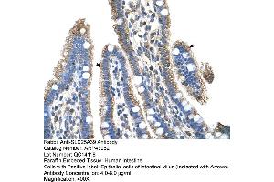 Human Intestine (SLC25A39 Antikörper  (C-Term))