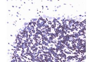 Immunohistochemistry (Paraffin-embedded Sections) (IHC (p)) image for anti-Jun Proto-Oncogene (JUN) (AA 26-175) antibody (ABIN967903)