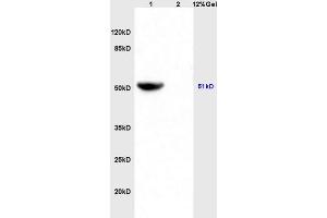 Lane 1: mouse heart lysates Lane 2: mouse brain lysates probed with Anti IDH2 Polyclonal Antibody, Unconjugated (ABIN751558) at 1:200 in 4 °C. (IDH2 Antikörper  (AA 251-350))