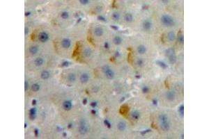 IHC-P analysis of Liver tissue, with DAB staining. (Insulin Receptor Antikörper  (AA 1024-1298))