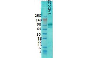 Western Blot analysis of Rat brain membrane lysate showing detection of PSD95 protein using Mouse Anti-PSD95 Monoclonal Antibody, Clone 7E3 . (DLG4 Antikörper  (Biotin))