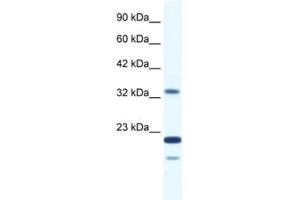 Western Blotting (WB) image for anti-Zinc Finger Protein 688 (ZNF688) antibody (ABIN2461301) (ZNF688 Antikörper)