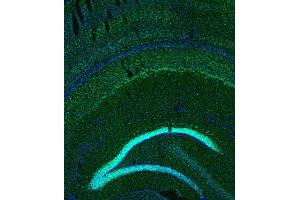 Indirect immunostaining of PFA fixed mouse brain section (dilution 1 : 200; green). (BCL11B Antikörper)