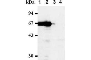 Western Blotting (WB) image for anti-Cell Division Cycle 7 (CDC7) antibody (ABIN487481) (CDC7 Antikörper)