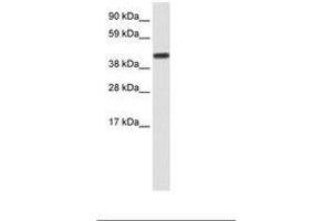 Image no. 1 for anti-CCR4-NOT Transcription Complex, Subunit 2 (CNOT2) (AA 112-161) antibody (ABIN202350) (CNOT2 Antikörper  (AA 112-161))