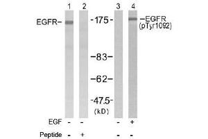 Image no. 2 for anti-Epidermal Growth Factor Receptor (EGFR) (Tyr1092) antibody (ABIN197230) (EGFR Antikörper  (Tyr1092))