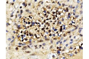 IHC analysis of EXOSC3 using anti-EXOSC3 antibody (ABIN7602216). (EXOSC3 Antikörper  (AA 64-275))