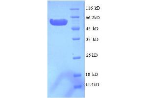 Inositol-1-Monophosphatase (AA 1-267), (full length) protein (GST tag)