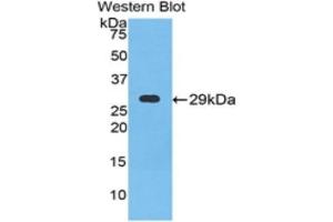 Western Blotting (WB) image for anti-Neuronal Pentraxin 1 (NPX1) (AA 146-384) antibody (ABIN1860045) (NPX1 Antikörper  (AA 146-384))