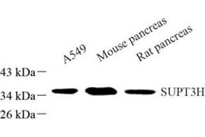 Western blot analysis of SUPT3H (ABIN7075767) at dilution of 1: 500 (SUPT3H/SPT3 Antikörper)